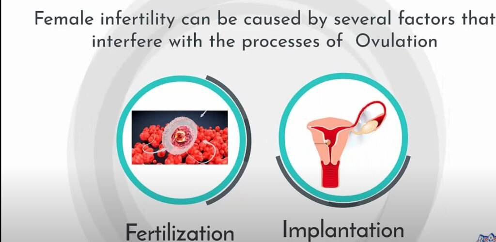 Female Sterility